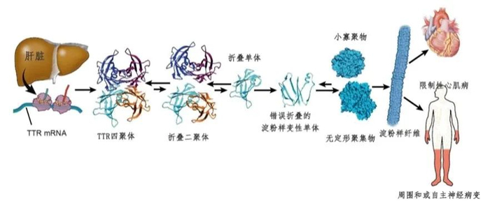 图5：转甲状腺素蛋白淀粉样变性（ATTR）简介
