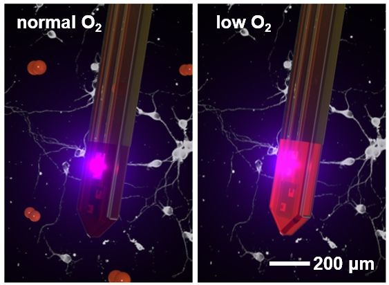 图为植入式微型光电探针工作示意图。（受访者供图）