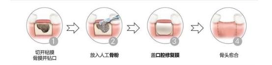 资料来源：公开资料