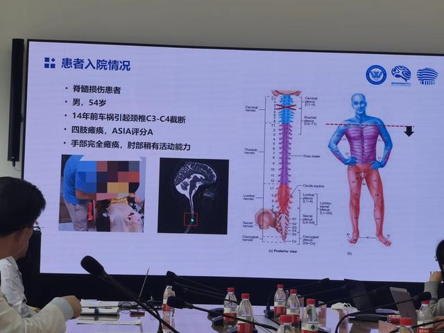 颈椎处脊髓完全性损伤患者老杨的病例分析。  新京报记者 戴轩 摄