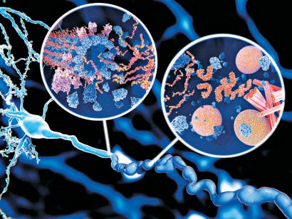 与阿尔茨海默病息息相关的Tau蛋白示意图