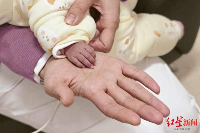 ▲刚出生的喜悦小手与成人手臂对比