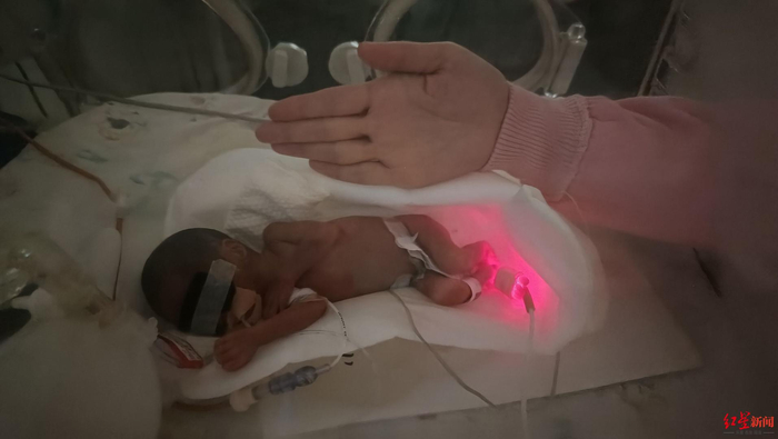 ▲刚出生的喜悦只有成人巴掌大小