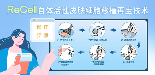 ①1分钟·超快取皮：1分钟即可完成患者健康皮肤的取皮，超薄取皮，对健康皮肤几乎没影响。