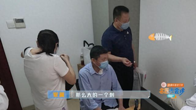 六次手术，富豪被1根鱼刺折磨瘦了130斤