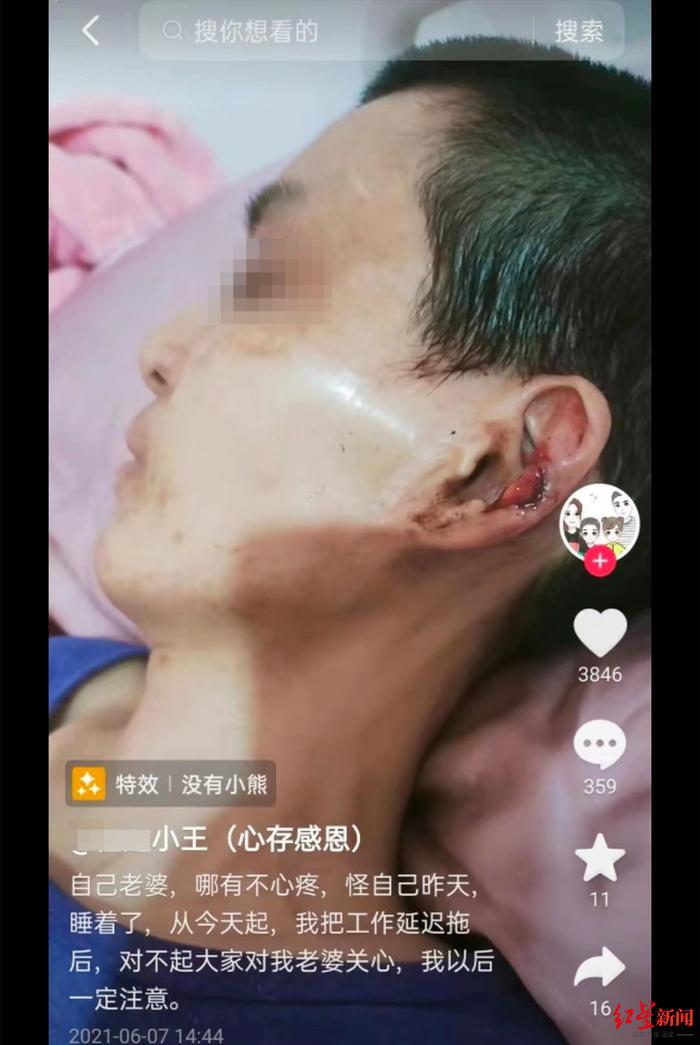 ▲小潘耳朵受伤的视频截图。受访者供图