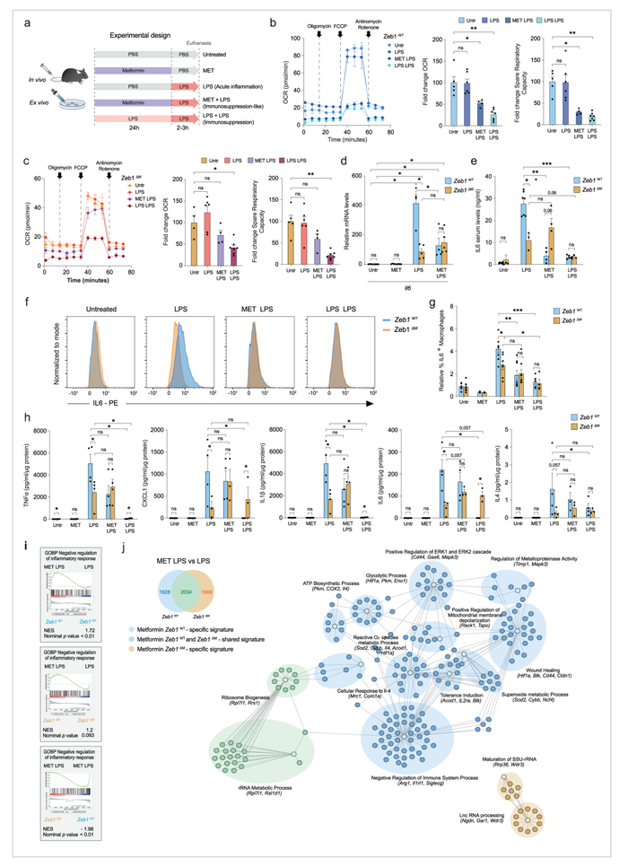 图3 二甲双胍的抗炎作用依赖于巨噬细胞中ZEB1的表达