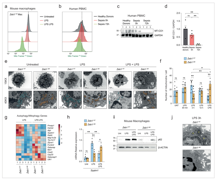 图2 ZEB1在炎症期间调节线粒体含量和自噬