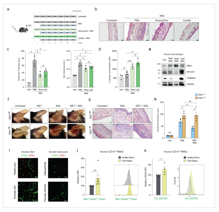 图5二甲双胍在银屑病皮损中的抗炎作用依赖于巨噬细胞中ZEB1的表达