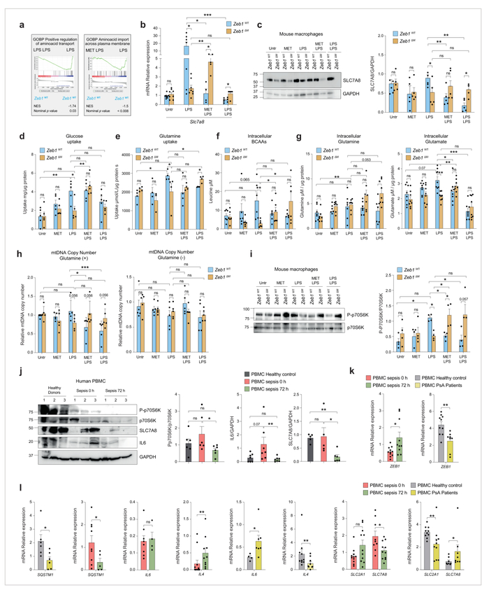 图6 ZEB1通过限制氨基酸转运来抑制线粒体蛋白质翻译