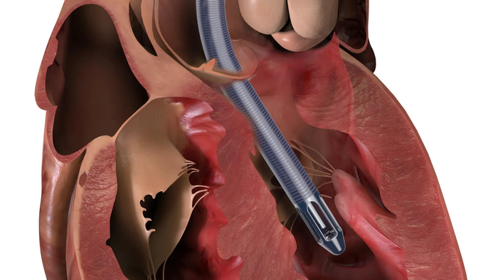 ▲带有SmartAssist功能的Impella 5.5渲染图