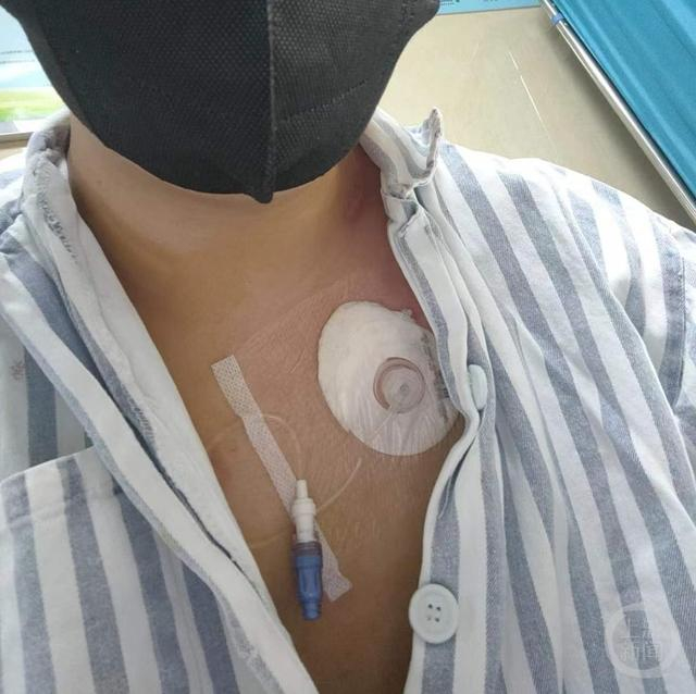 “得到了复活卷轴”的小冯。受访者供图 