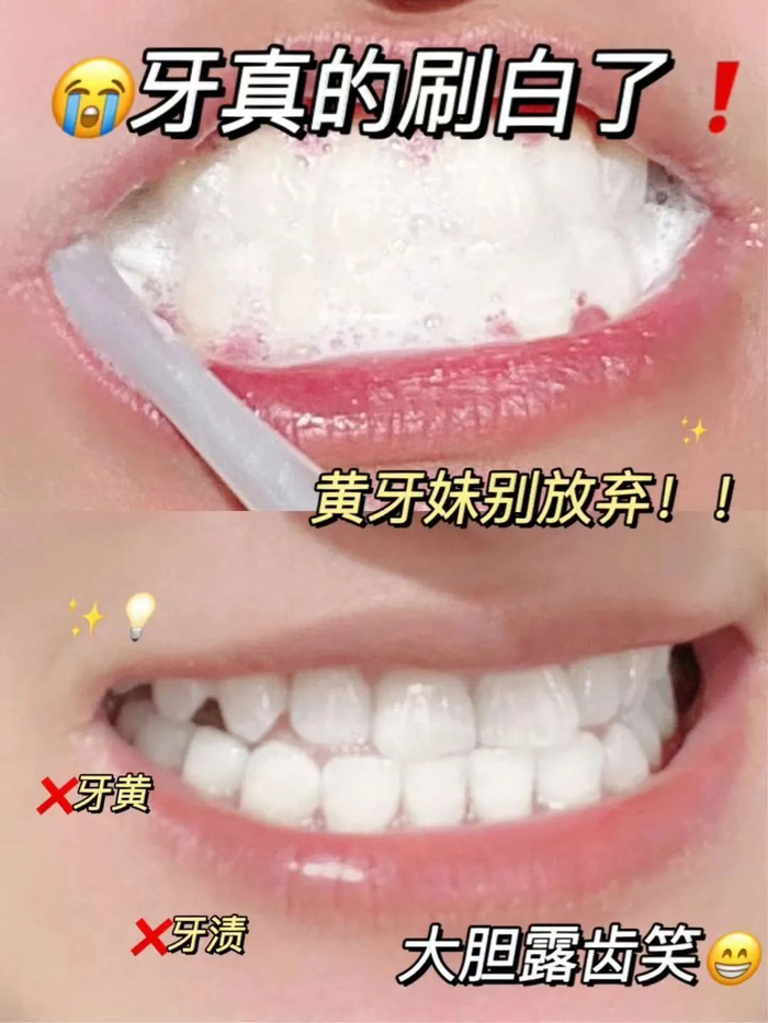 图片仅供参考，实际美白效果因人而异
