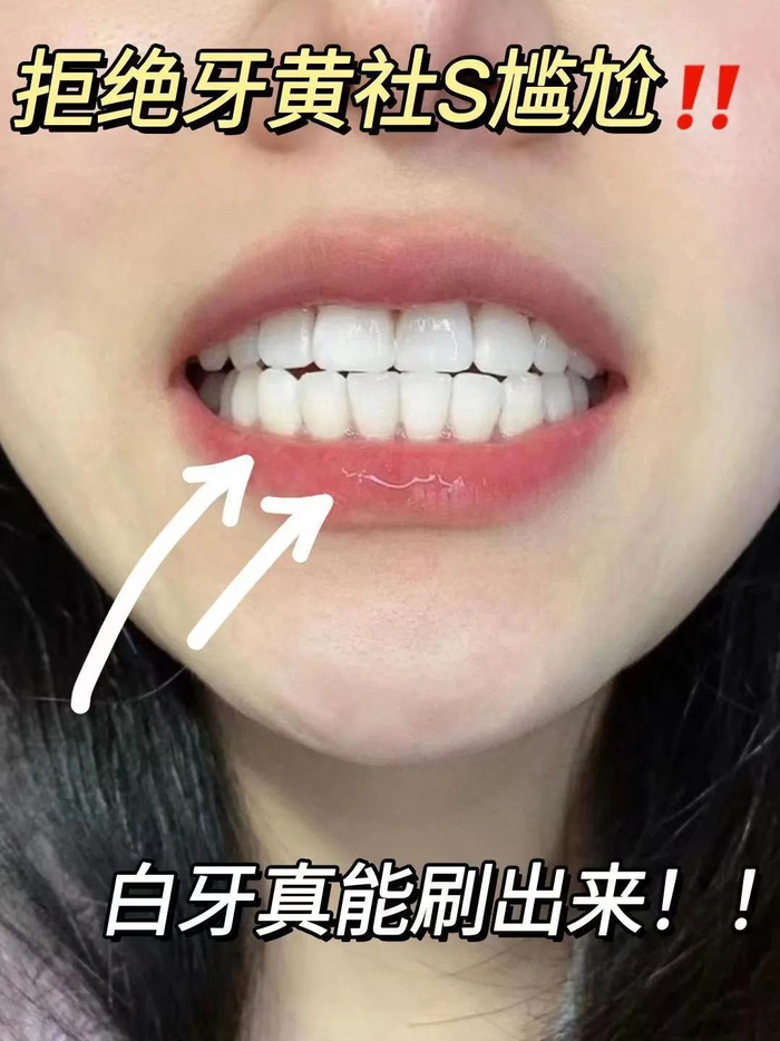图片仅供参考，实际美白效果因人而异