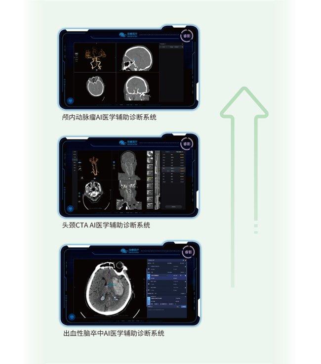 睿影一站式CT出血性脑卒中智慧解决方案
