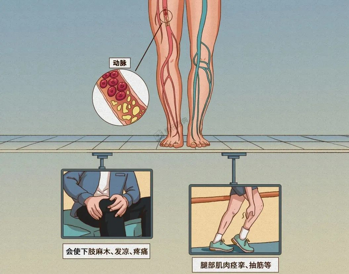 图源：腾讯医典