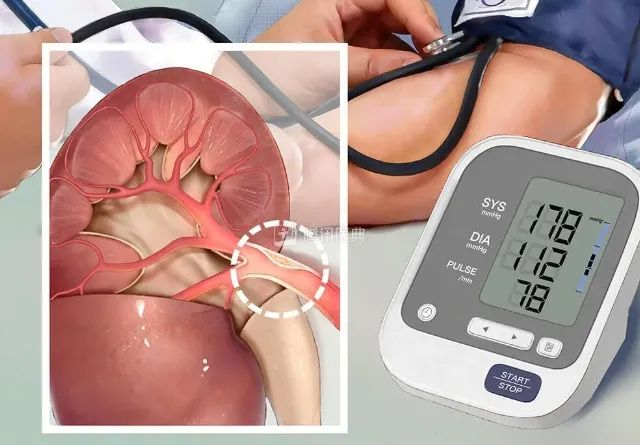 图源：腾讯医典