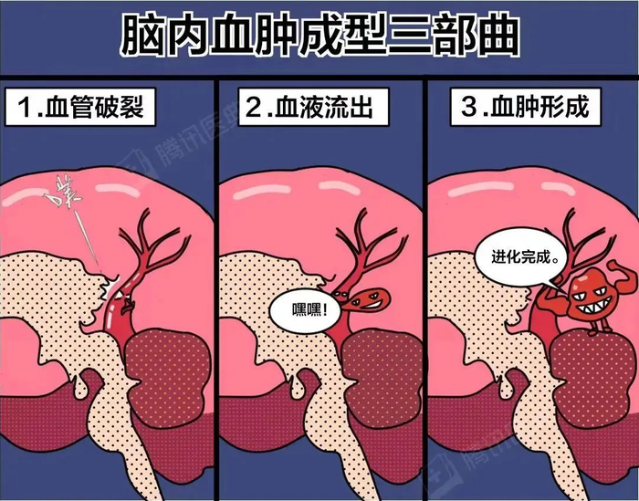 图源：腾讯医典