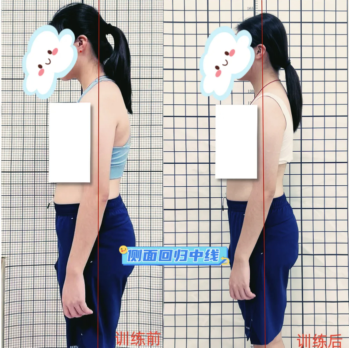 训练效果。图源/南海人医