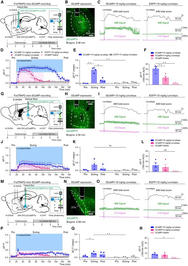图2 三个关键脑区中异动激活亚群对异动的响应