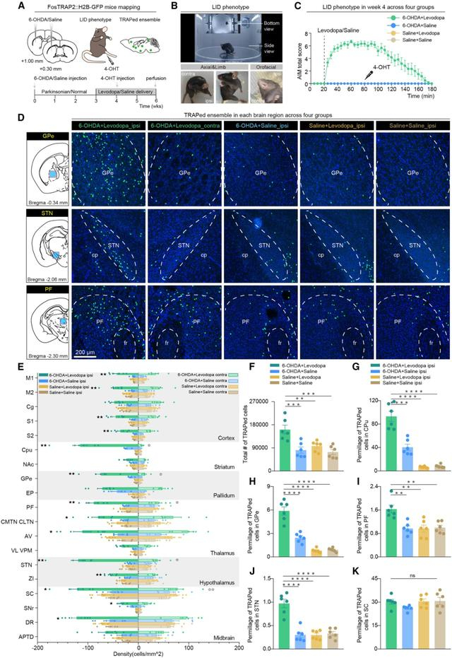 图1 全脑筛选特异性包含异动激活集群的关键脑区