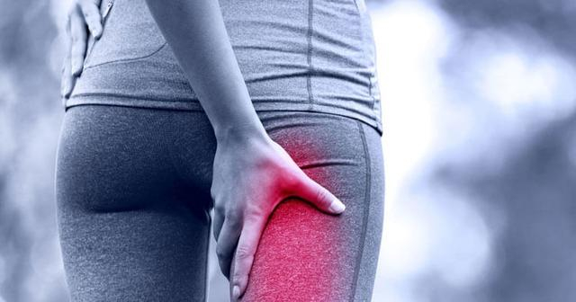 图：梨状肌综合征患者常见臀部疼痛