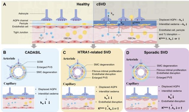 图6 各cSVD亚型中BBB功能障碍相关机制的推测