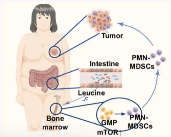 高脂饮食促进癌症发展的机制：肠道