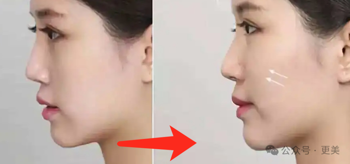 △也和鼻基底发育不良有关系