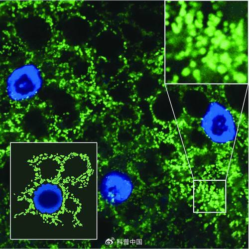 敲降CG11837基因后，黑腹果蝇脂肪体中线粒体的形态变得异常。课题组供图