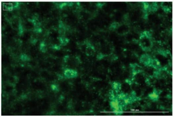 图4 肝细胞对LNP-102的摄取（LNPs中的BODIpY-胆固醇会发出绿色荧光）