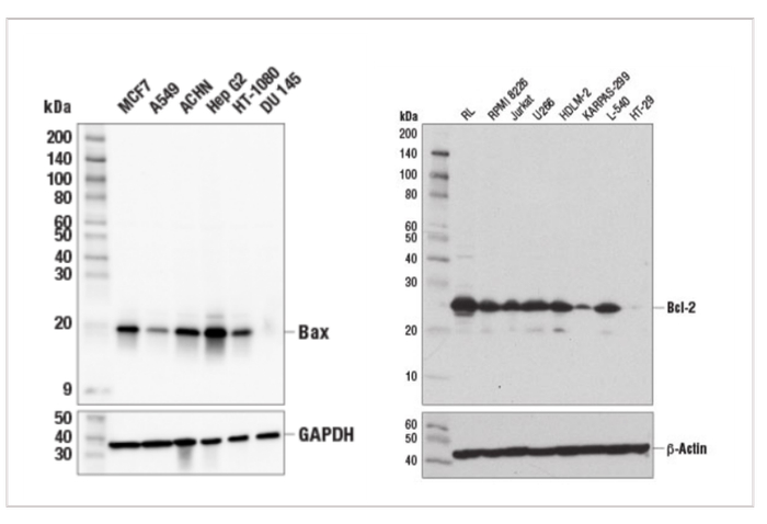 图2 Bax和Bcl-2在不同细胞系的表达情况