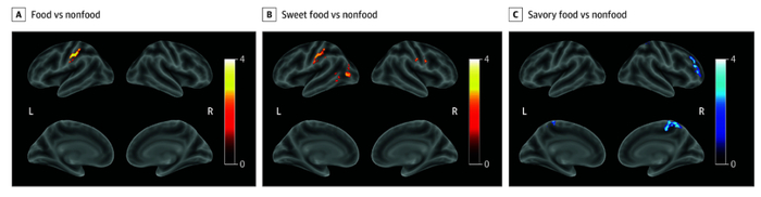 图2：高感知组和低感知组的全脑比较