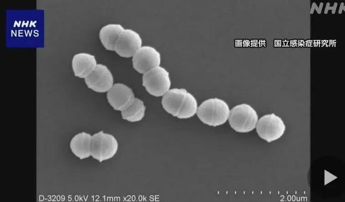 日本“食人菌”感染病例超1100例