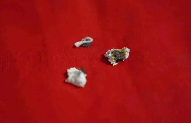  高性宽骨灰中的三枚弹片晶体。图片均为受访者供图