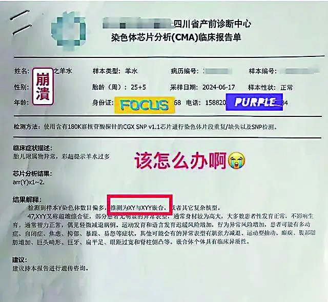     网上发布的临床报告单
