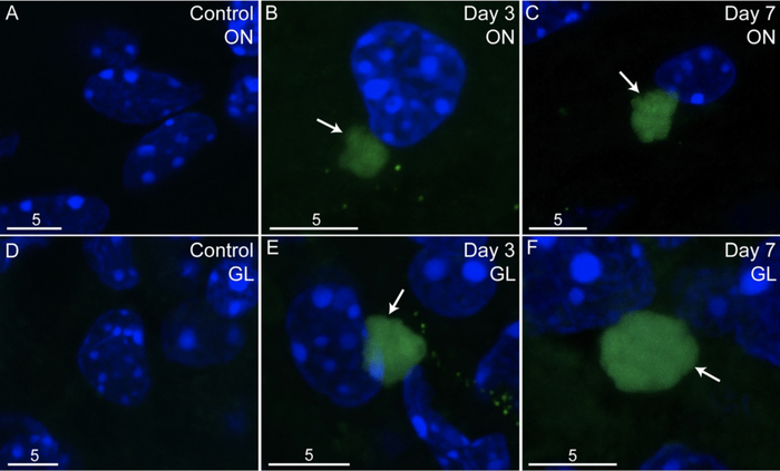 嗅觉上皮损伤后，嗅觉神经、嗅球和大脑的肺炎衣原体感染情况