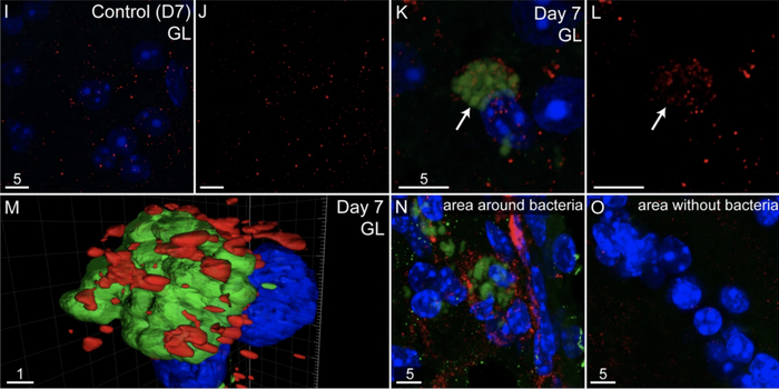 肺炎衣原体和β淀粉样蛋白沉积物在嗅球中的形态