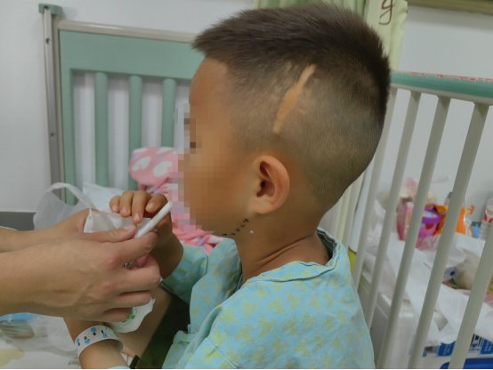 ▲小白头上的伤疤。新京报记者 刘思维 摄