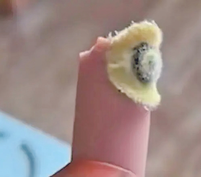     有异物的火腿肠