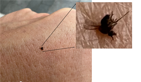 被拍死的蠓。来源：作者拍摄