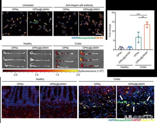 图2.OPNs@LMWH能够被巨噬细胞高效摄取并能够靶向结肠炎症部位