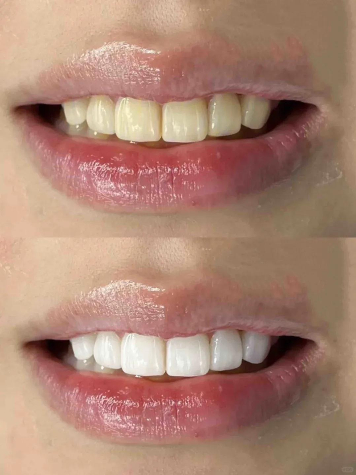 （图为个人使用反馈，实际效果因人而异）