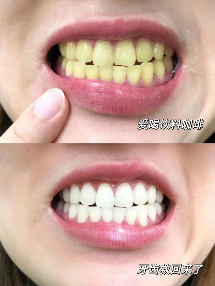 （图为个人使用反馈，实际效果因人而异）