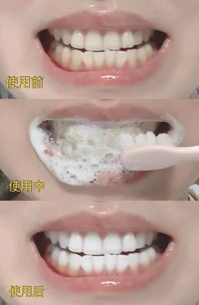 （图为个人使用反馈，实际效果因人而异）