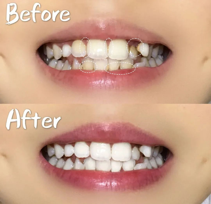 （图为个人使用反馈，实际效果因人而异）