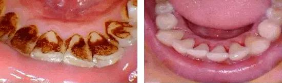 （图为个人使用反馈，实际效果因人而异）