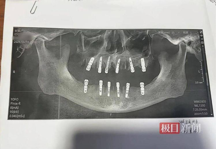 相关口腔影像资料（图源当事人社交账号）