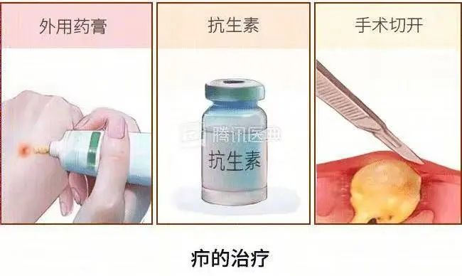 ▲图源：腾讯医典