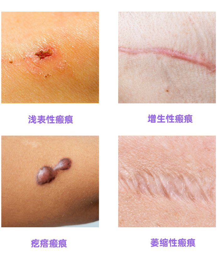 图片来源：图虫